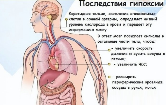 последствия неправильного прикуса.